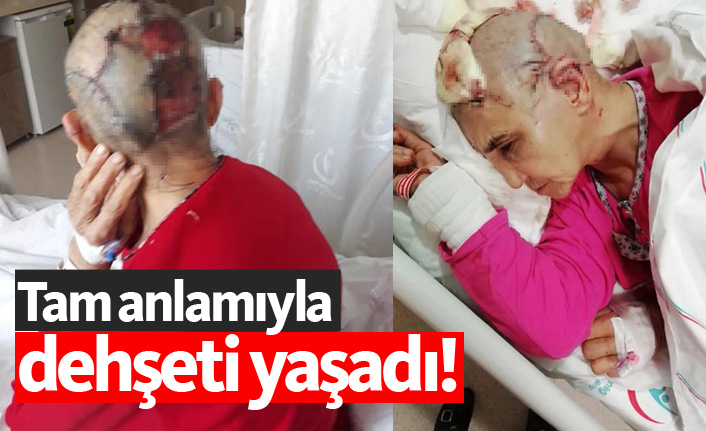 Tam anlamıyla dehşeti yaşadı