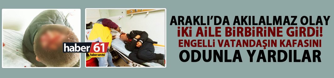 Trabzon'da akılalmaz olay! Kafasını odunla yardılar!