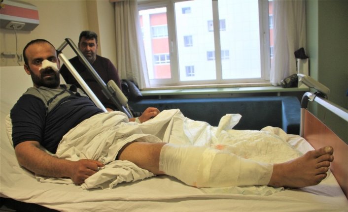 Köpekler saldırdı, burnunu ve bacağını parçaladı