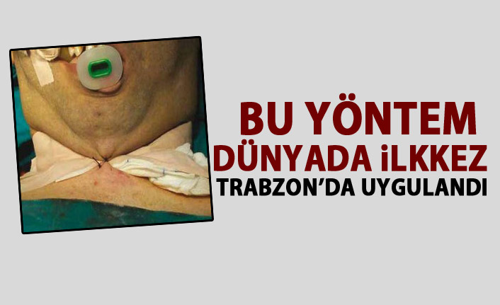 Bu yöntem dünyada ilk kez Trabzon’da uygulandı