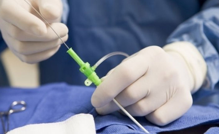 Kapalı kalp delikleri için anjioya benzeyen yöntem