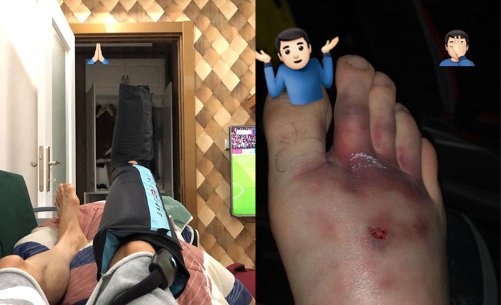 Amiri ile ikili mücadeleye giren Lopes ayağının son durumu paylaştı