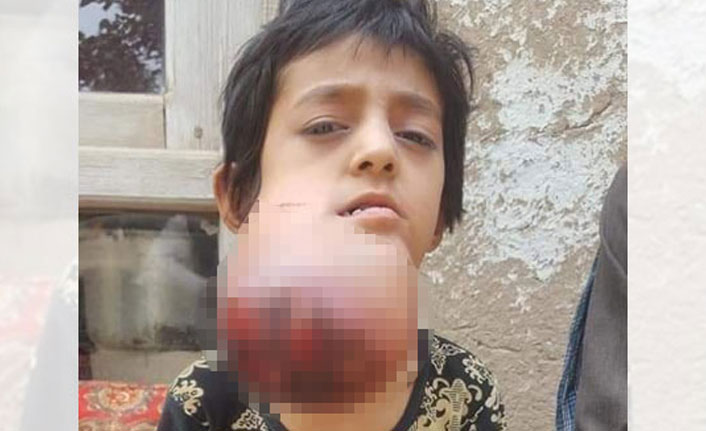 Küçük Habibe yardım bekliyor