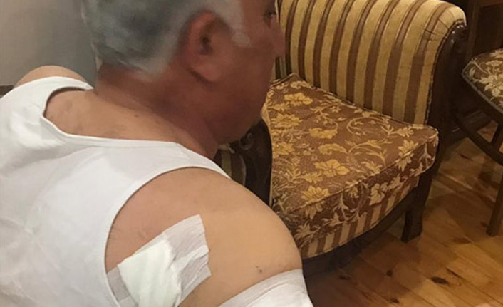 Belediye başkanına köpek saldırdı