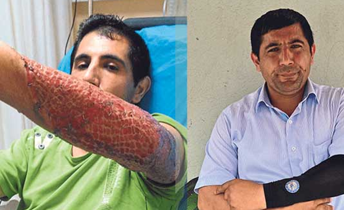 Her şey üç dikişler başladı!