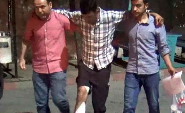 Kız kavgası kanlı bitti!