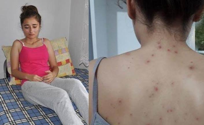 Arılar genç kıza dehşeti yaşattı!