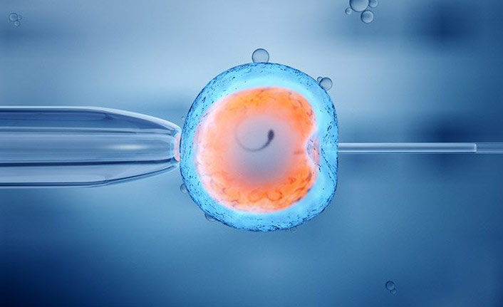 Kıbrıs’ta Uygulanan Tüp Bebek Tedavileri