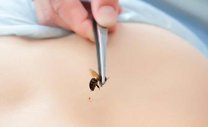 Karadeniz’e arı alerjisi uyarısı!