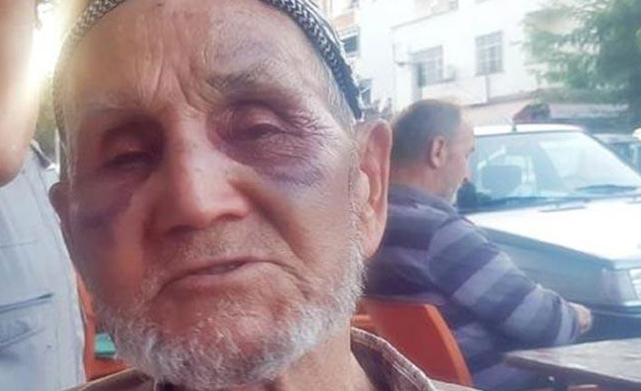 Babasını satırla döven cani tutuklandı