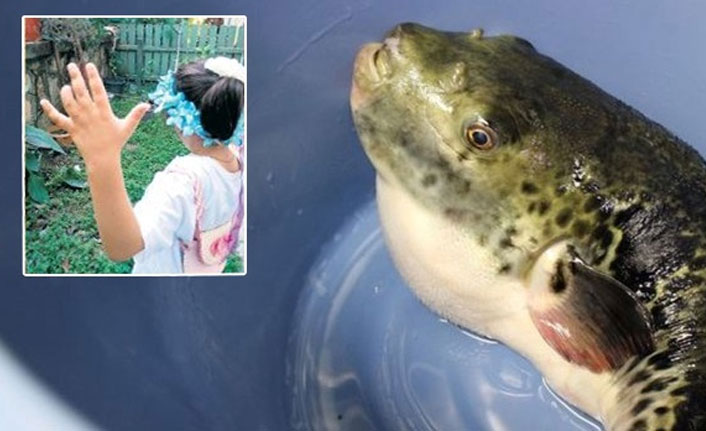 Türkiye'de ilk balon balığı saldırısı