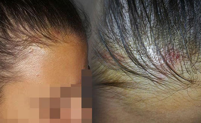 Okul müdürünün öğrenciye kapı kolu fırlattığı iddiası