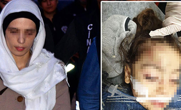 3 yaşındaki kız çocuğunu döverek komaya soktu!