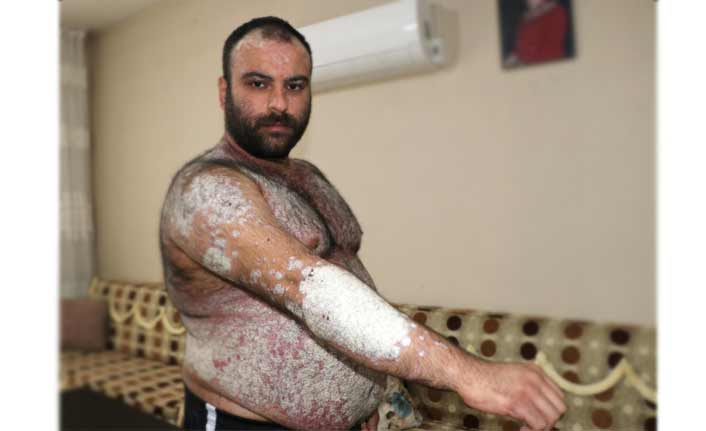 Kimse korkmasın diye dışarı çıkmıyor!