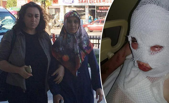 Komşularına kezzapla saldıran kadına hapis cezasında 'Pişman olmama' vurgusu