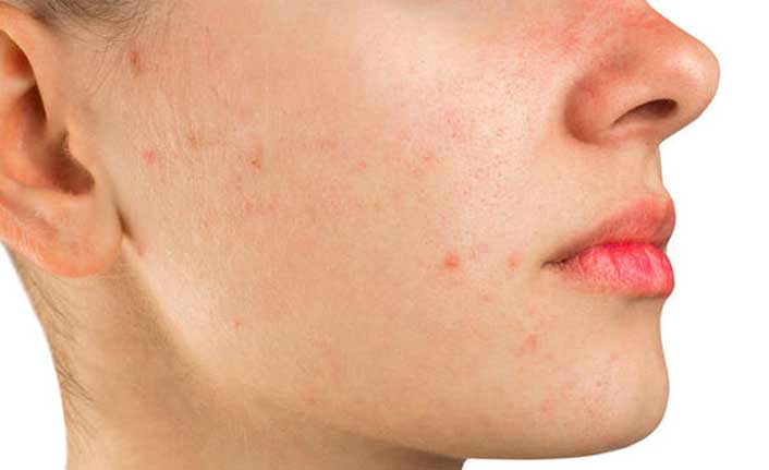 Dr. Özgür Uyardı: Cilt Lekeleri Neden Oluşur ve Nasıl Geçer?