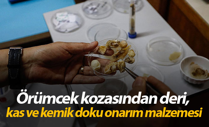 Örümcek kozasından deri, kas ve kemik doku onarım malzemesi