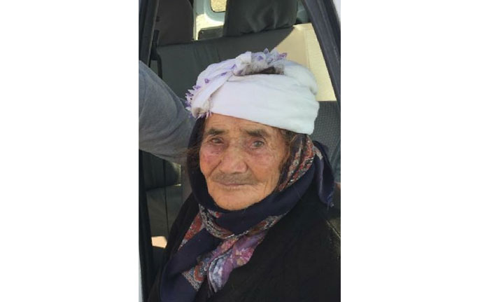 Sokak köpeği, yaşlı kadının yüzünü parçaladı