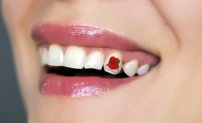 Diş Hekimi Uzunpınar: Diş dövmesi Türkiye’de hızla yayılıyor