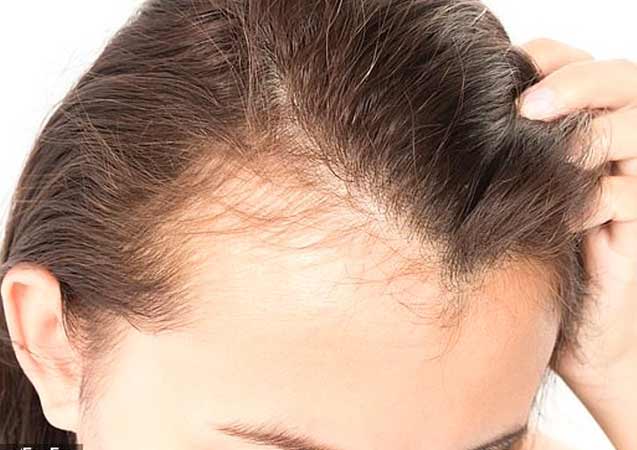 Mevsimsel geçişler saçları döküyor!