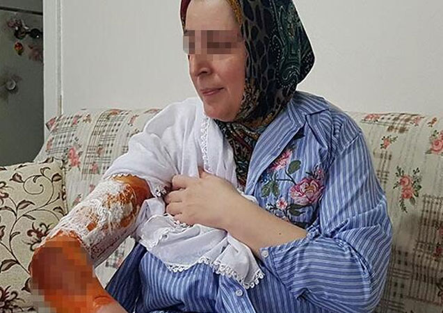 17 yıllık eşi kaynar su ile haşladı!