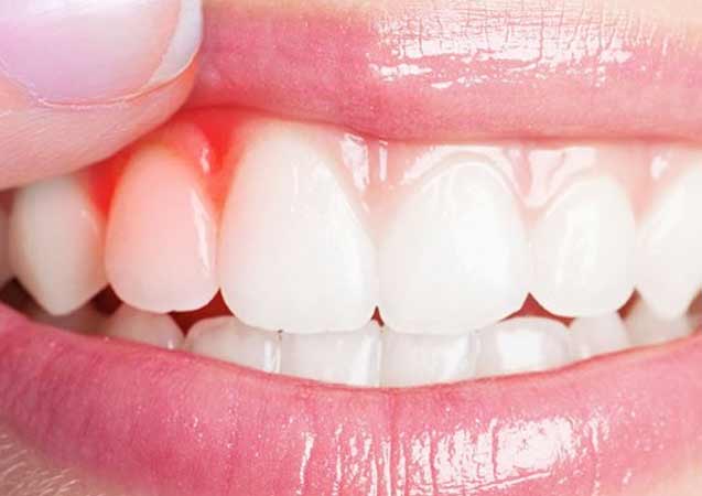 Diş Hekimi Uzunpınar: Diş Eti Hastalıklarında Erken Müdahale Hayati Önem Taşıyor