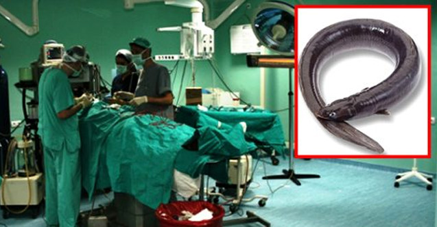 Yılan balığıyla kabızlık sorunu çözmeye kalkıştı! Doktorlar bile şoke oldu