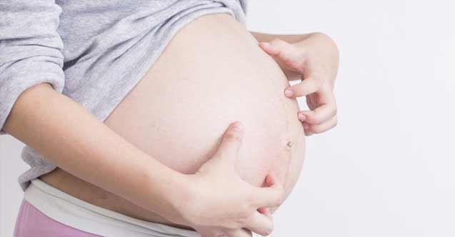 Hamilelikteki kaşıntılara dikkat!