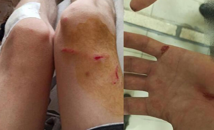 Köpek saldırısı bu hale getirdi!