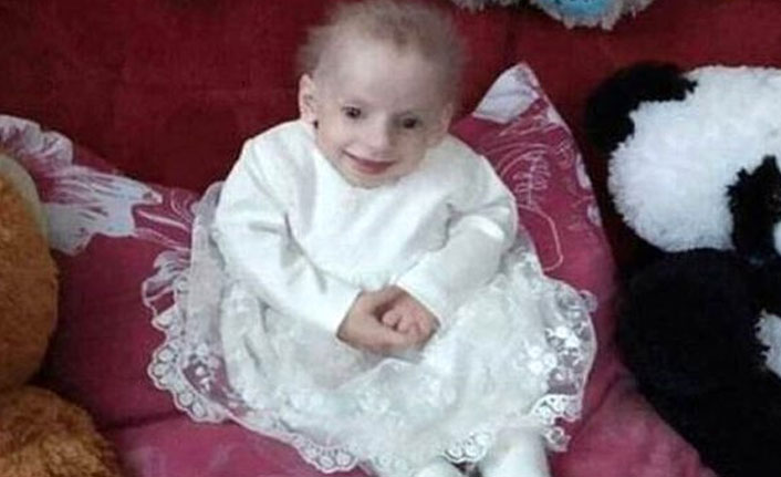 8 yaşındaki kız, yaşlılıktan hayatını kaybetti!