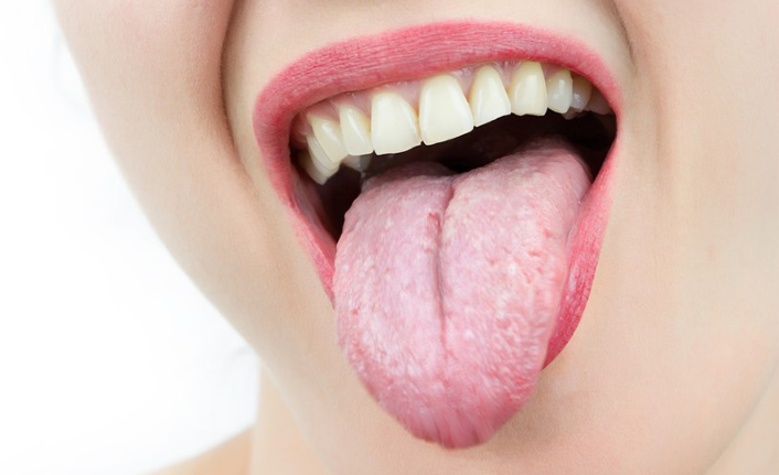 Kadınlarda bu hastalık 9 kat daha fazla görülüyor