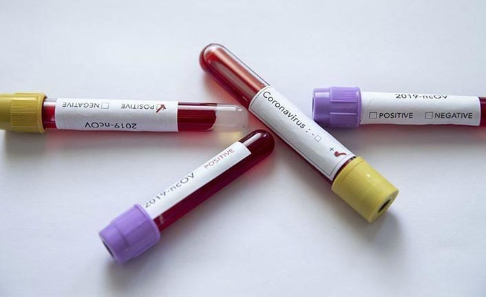 İran'da Sağlık Bakan Yardımcısı koronavirüse yakalandı