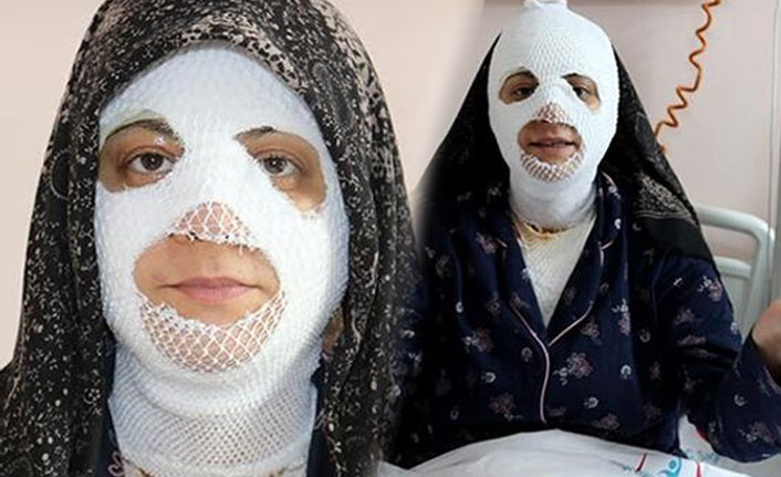 Düdüklü tencere patladı, bu hale geldi!