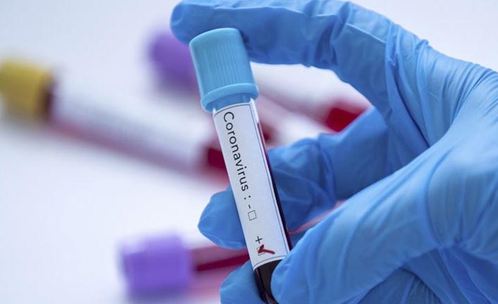 Dünyada Kovid-19 bulaşan kişi sayısı 85 bini aştı