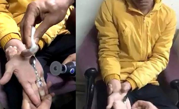 Parmağına sıkışan yüzüğü itfaiye çıkarttı