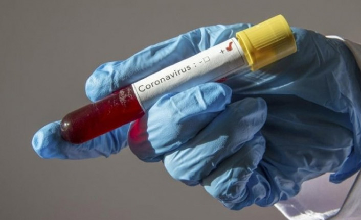 Çin'de koronavirüs salgınında ölenlerin sayısı 2 bin 983'e çıktı