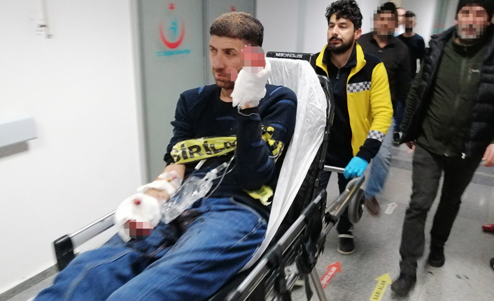 Elinde havai fişek patladı