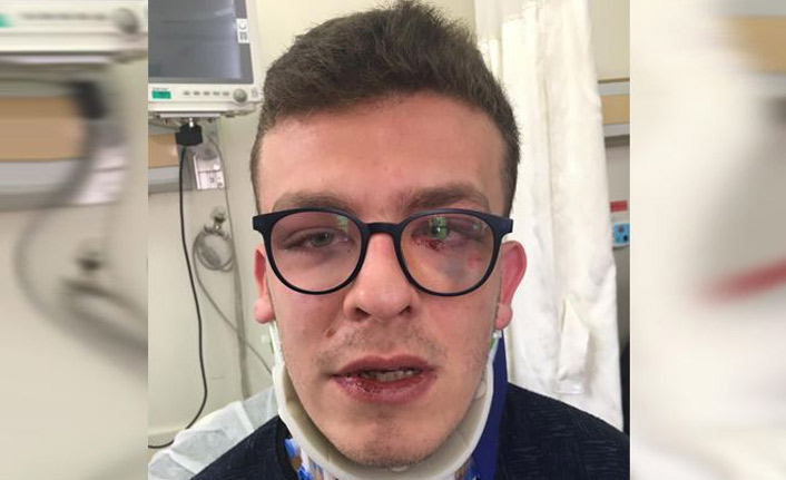 Otizmli genci döverek hastanelik etti