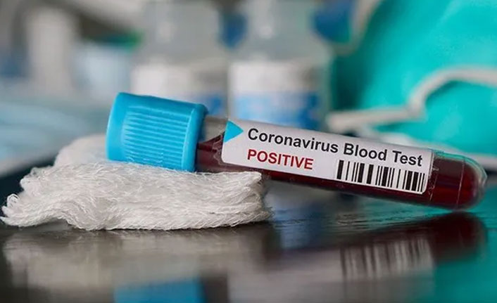 Okullara koronavirüs tatili gelecek mi?