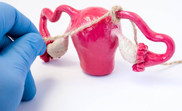 İşte tüp bağlama yöntemi ile ilgili bilinen 5 yanlış