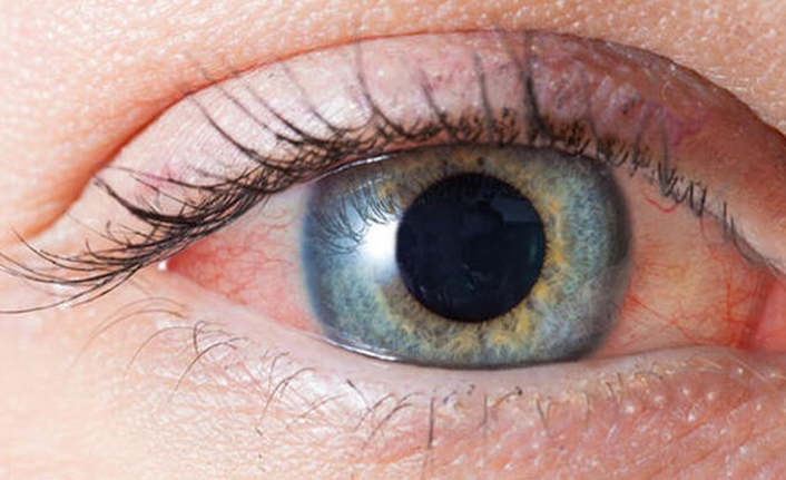 Gözde aşırı sulanmaya dikkat: Kanal tıkanıklığı ciddi risk taşıyor