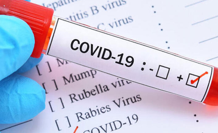 KKTC’de koronavirüs vakası 38 oldu