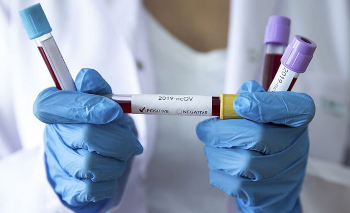 Milli takıma koronavirüs şoku!