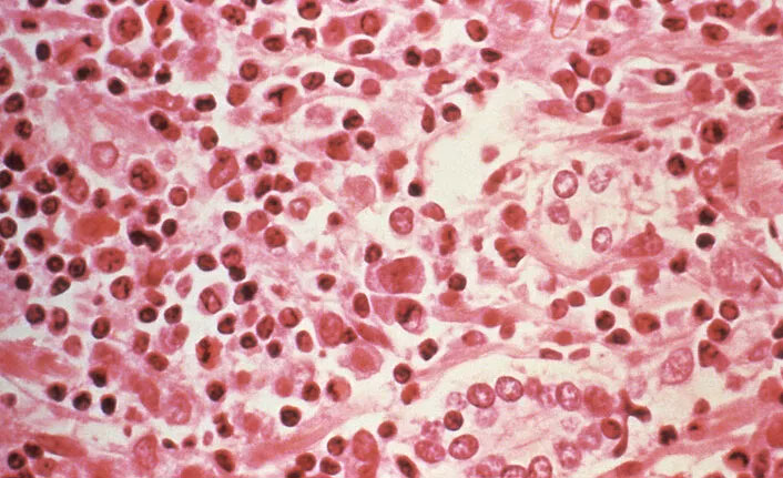 Koronavirüsü atlatamadan şimdi de hantavirüs salgını mı?