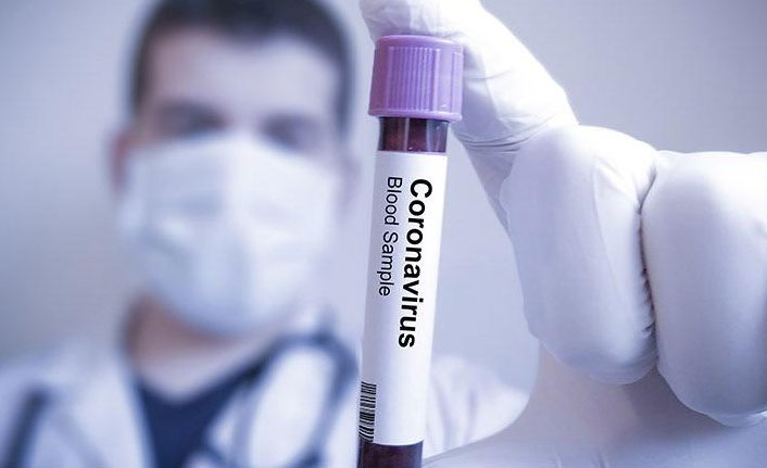 Bakan açıkladı, koronavirüsten ölenlerin sayısı arttı!