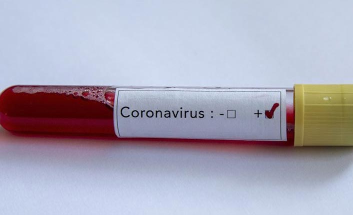 KKTC'de Kovid-19 nedeniyle ilk ölüm