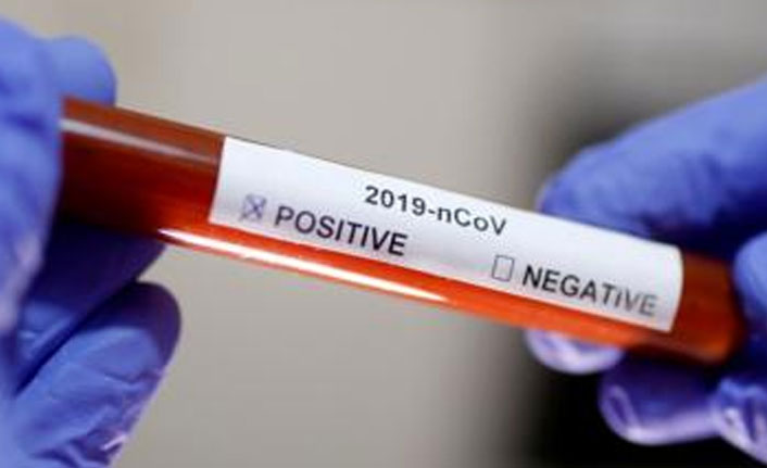 ABD'de ölü sayısı 2 bin 191'e yükseldi