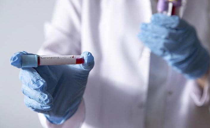 Beklenen haber geldi! Koronavirüs ilacı 7 ülkede denenmeye başlandı