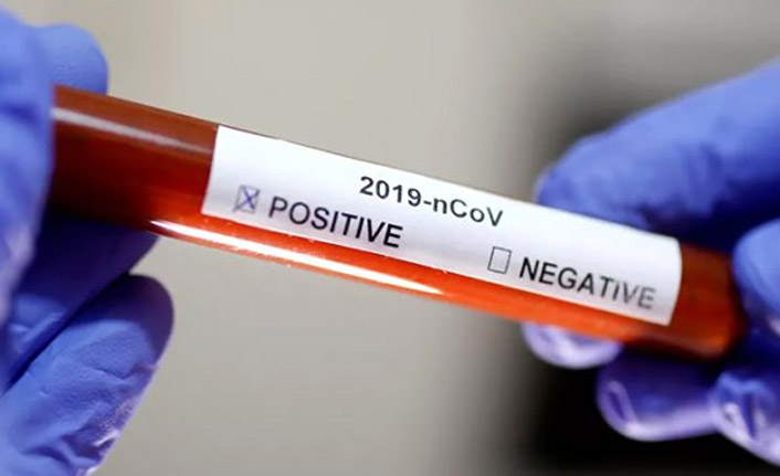 Dünya genelinde koronavirüs vaka sayısı 750 bini geçti