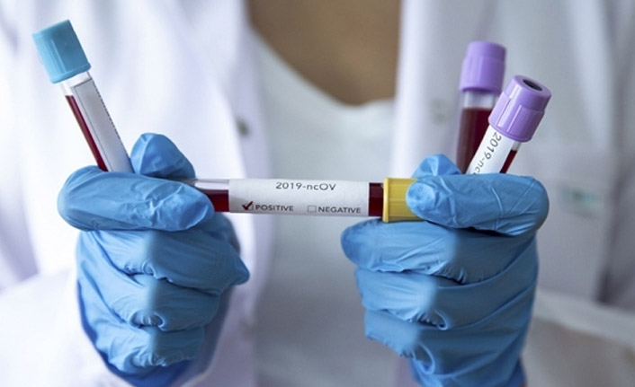 Trabzon'da koronavirüsten ölenlerin sayısı arttı